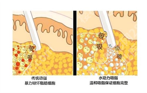 运城市中心医院整形科吸脂怎么样?看医院口碑、亮点介绍