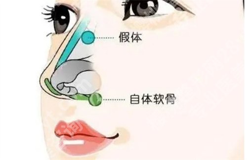 北京协和医院做鼻子多少钱？2024年全新收费详情公布
