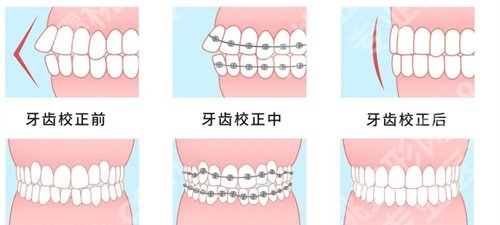 六安人民医院牙科专家有谁？一起来看医院技术优势