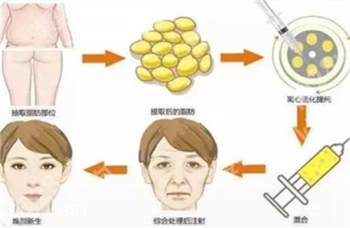 深圳悦她张赫怎么样?医生信息介绍,特色项目查看