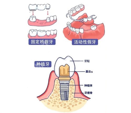 佛山第一人民医院牙科是外包的吗?技术优势点评