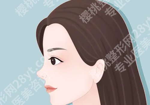 邓柏林做鼻子怎么样?内附手术全过程以及挑选医生小经验