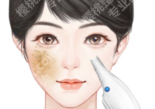 重医附一院点阵激光怎么样？皮肤科详情、用户反馈分享