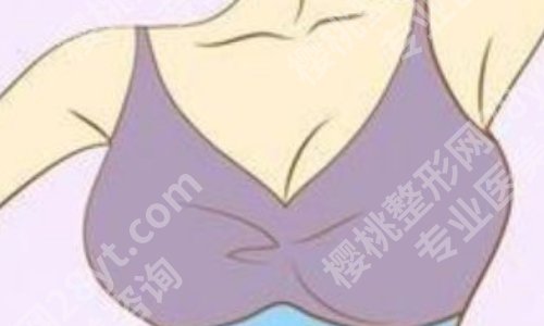 广东省人民医院隆胸怎么样？医院亮点、交通导航、院内案例来袭！