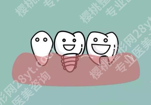 三水人民医院牙科可以挂号吗?医院亮点、交通导航、案例曝光!