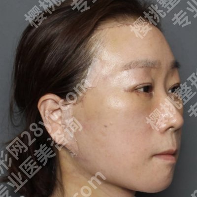 北京协和医院激光美容技术好吗?医生资料、面诊攻略更新!