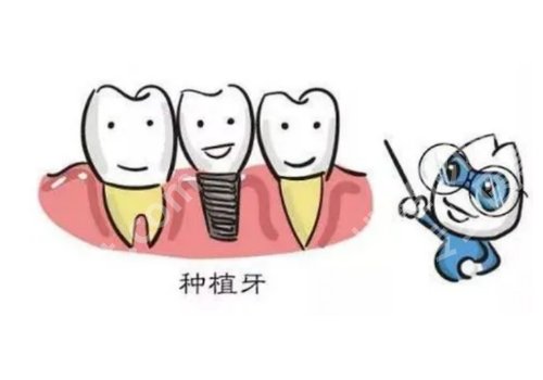 哈尔滨种牙好的医院排名!2026人气医院分享与顾客点评