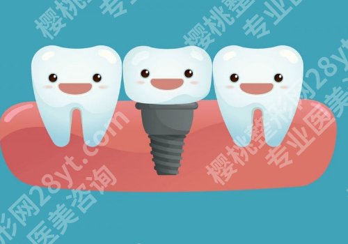 石家庄种牙哪家好?多家人气医院榜单,请收好