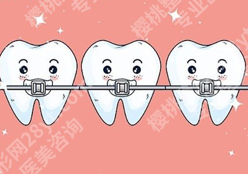 成都牙齿矫正性价比高的医院有哪些?华西口腔医院、人民医院等上榜
