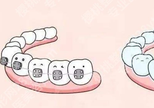 遵义牙齿矫正哪家好?2026口碑医院分享,选对,少踩坑