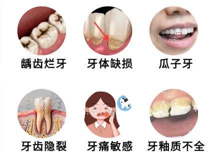 牙齿修复