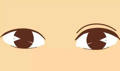 单眼皮