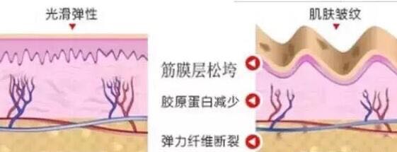 深圳希思整形医院热玛吉价格2023新鲜出炉！附医院特色项目、坐诊医生介绍~