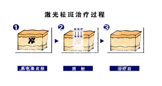 北京华韩医疗美容祛斑价格2023年更新,内附张冬梅、王新玉医生简介!