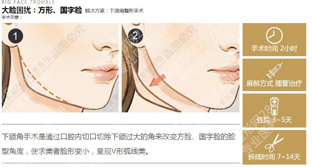 北京圣嘉新磨骨医生名单:张笑天\张立天\邱立东,本院实力派