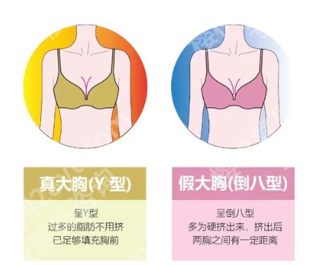 董岩岩隆胸技术好吗？医生个人介绍、擅长项目介绍！