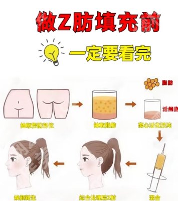 北京画美注射技术怎么样？真实的口碑点评来袭！