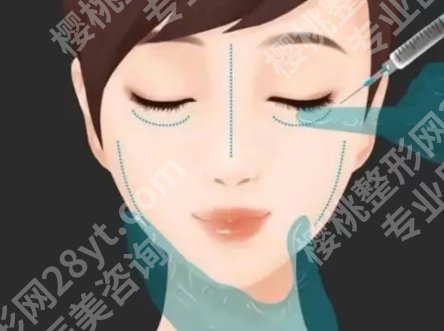 北京画美注射技术怎么样?真实的口碑点评来袭!