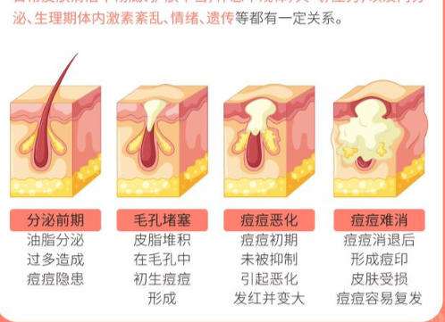 祛痘2.jpg 祛痘2.jpg