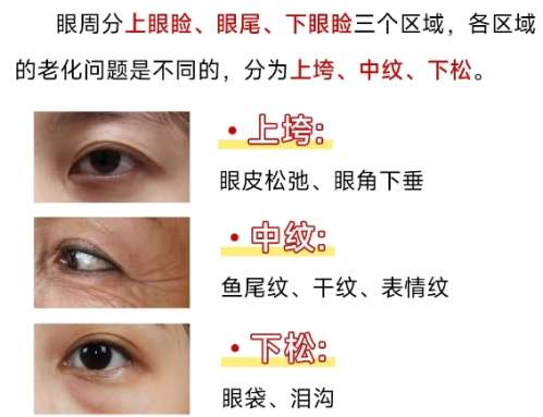 眼周整形