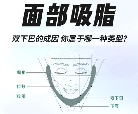 面吸