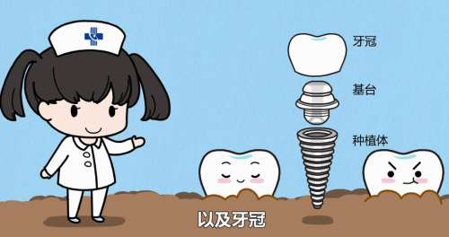 牙齿种植