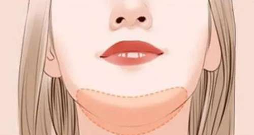 下巴1.jpg 下巴1.jpg