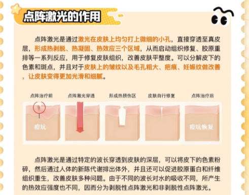 点阵激光1.jpg