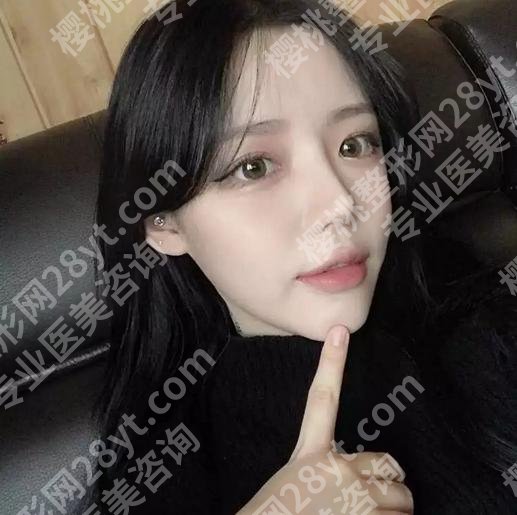 上海九院植发挂什么科？公布科室信息与真实案例分享