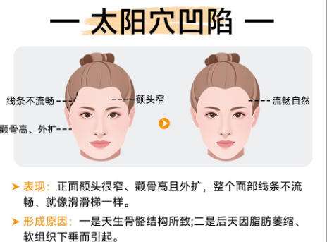 磨骨3.jpg