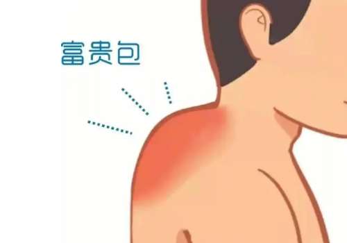 富贵包2.jpg