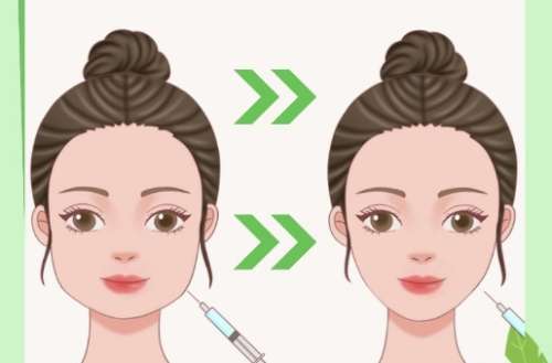 瘦脸 瘦脸
