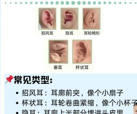 耳再造4.jpg 耳再造4.jpg