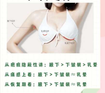隆胸