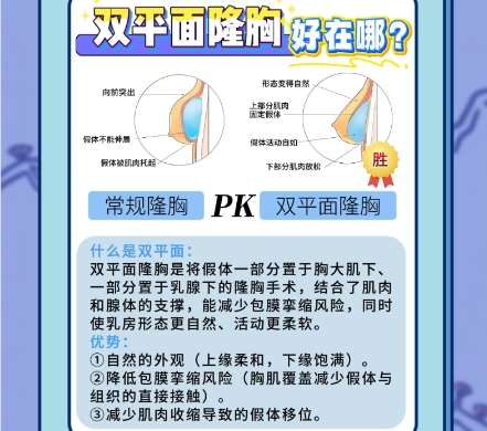 隆胸 隆胸