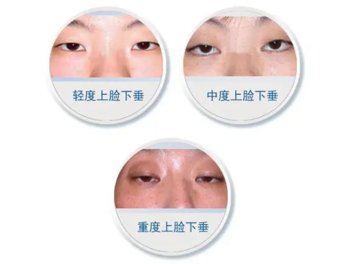 QQ20241014-112039.png