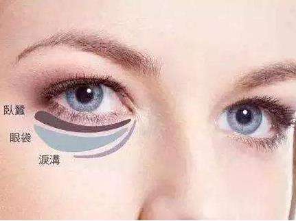 眼袋1.jpg