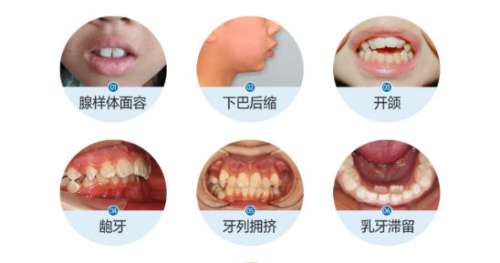 牙齿矫正动漫科普.湛江市珠江口腔医院