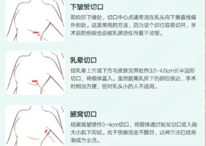 聂志宏医生怎么样？医生个人简历展示！价格表新鲜出炉！