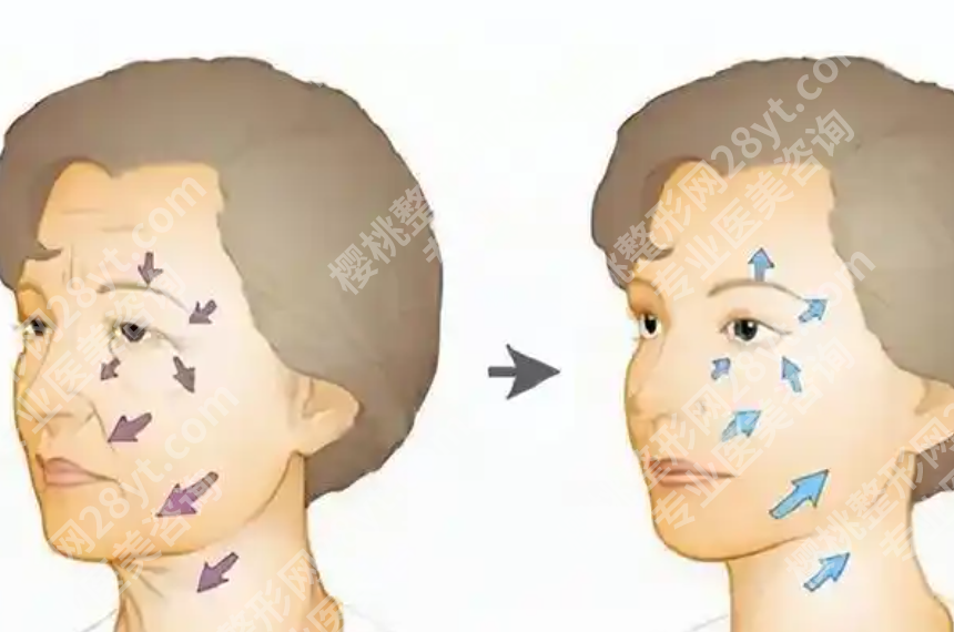 吉林省做拉皮手术医院有哪些值得关注?想做年轻化提升的人可以先了解