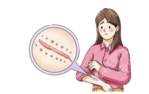 上饶有去疤医院吗?当地能做疤痕治疗的机构整理出来了,附方案推荐