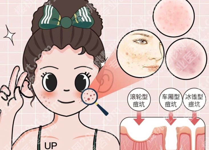 宁波激光祛斑三甲医院有哪些?公立院皮肤科盘点,正规祛斑认准这几家