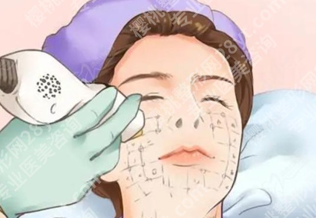 惠州激光祛斑哪家医院效果好?做过的人推荐这几家,附真实反馈参考