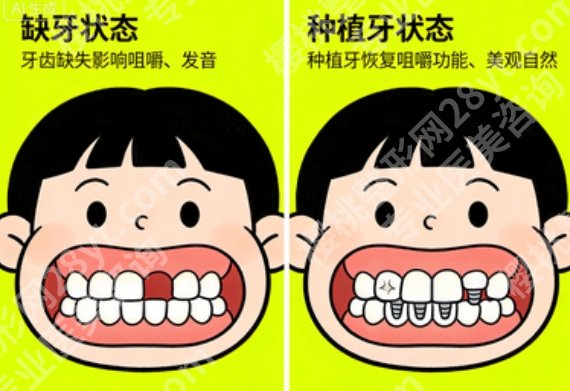 滁州满口种植牙医院有哪些？能做全口的靠谱机构汇总，想做的先了解