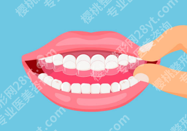 湖州牙齿矫正哪家医院好?口碑、医生实力、矫正方式多维对比