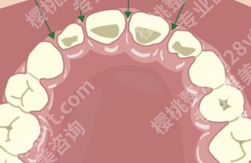 宝坻口腔医院哪个好?5家公立老牌机构实测,不踩坑不忽悠