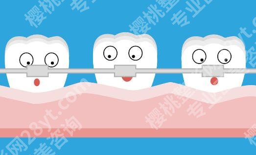 吉安牙齿矫正哪个医院好?5家公立机构真实体验,牙套党必看