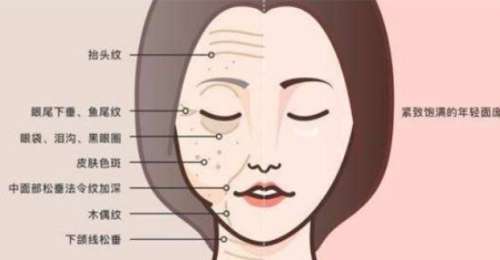 面部提升