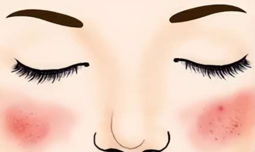 红血丝