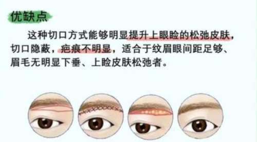 提眉 提眉